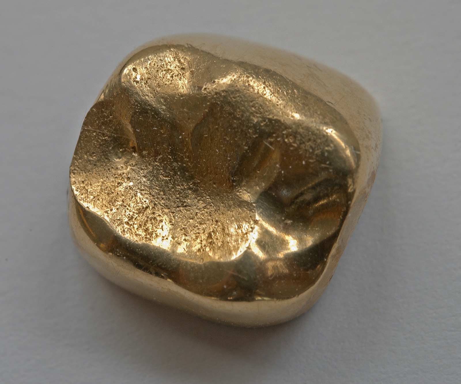 Foto: massief gouden tandkroon van dichtbij